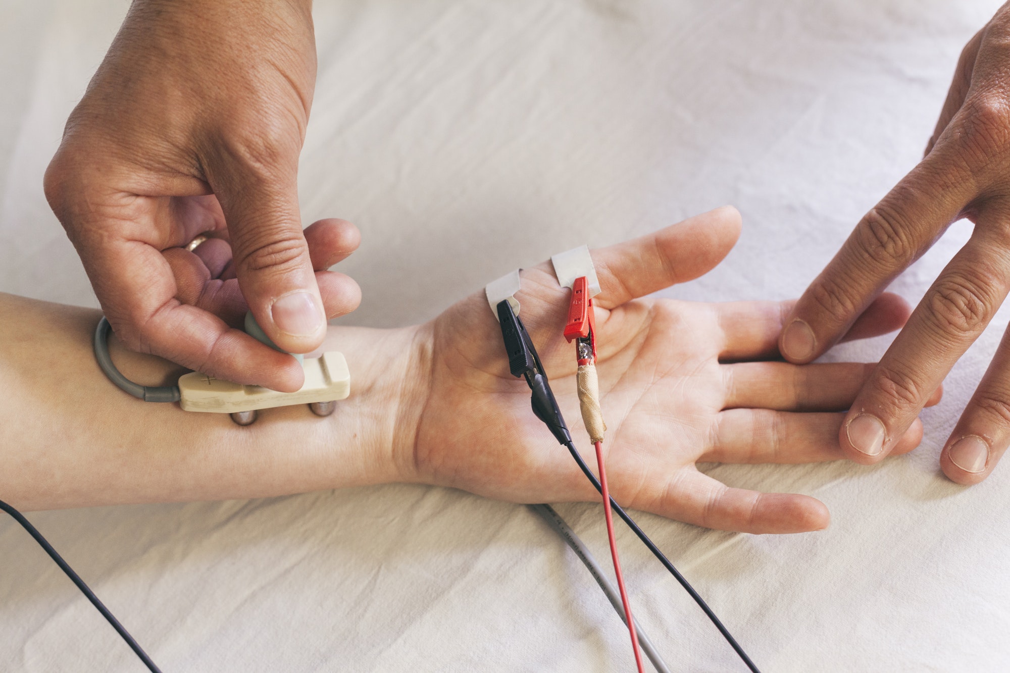 Chiropractor performing a Median NCV electrotherapy