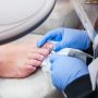 Podology treatment. Podiatrist treating toenail fungus. Doctor removes calluses, corns and treats